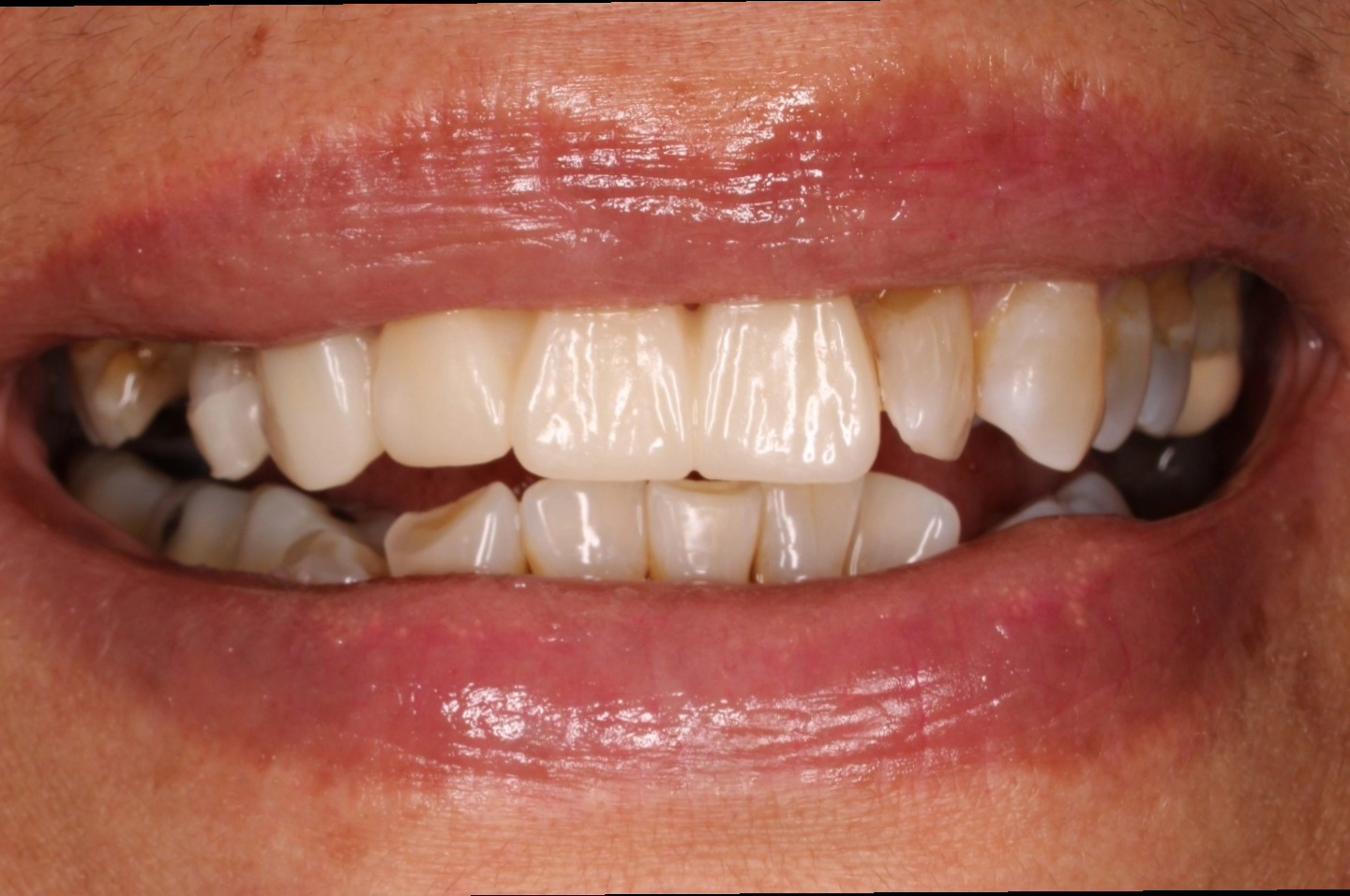 Tree Dent Consultorio Dental | Tuxtla Gutiérrez
