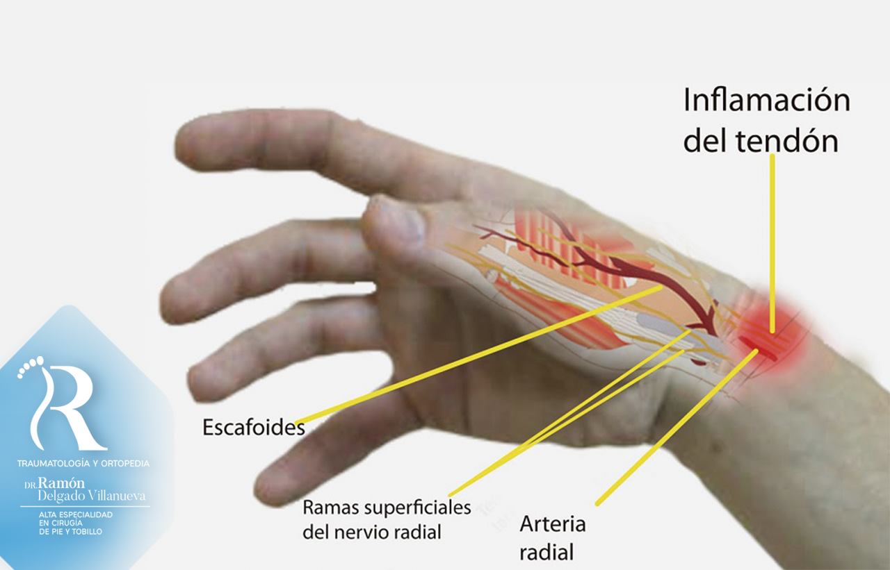 Bloqueo Del Dedo Del Gatillo En El Pulgar Y El Dedo Índice De La Mano Izquierda Delantera De La Mano Izquierda Gm1162536057 318910681 Bloqueo Del Dedo Del Gatillo En El Pulgar Y El Dedo Índice De La Mano Izquierda Delantera De La Mano Izquierda Gm1162536057 318910681