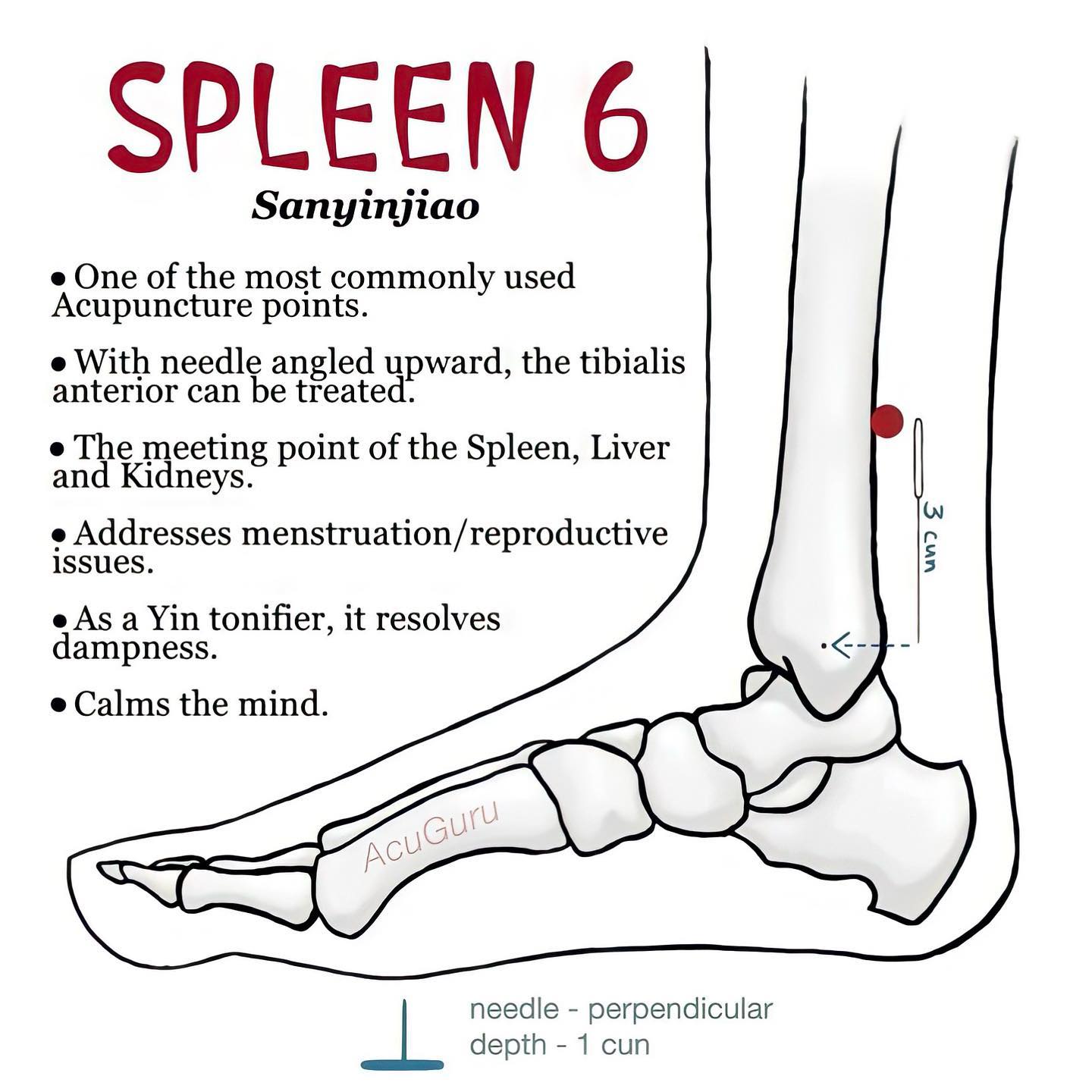 Jason Wincey - Halifax Sports Medicine Acupuncture - Spleen 6 • What a ...