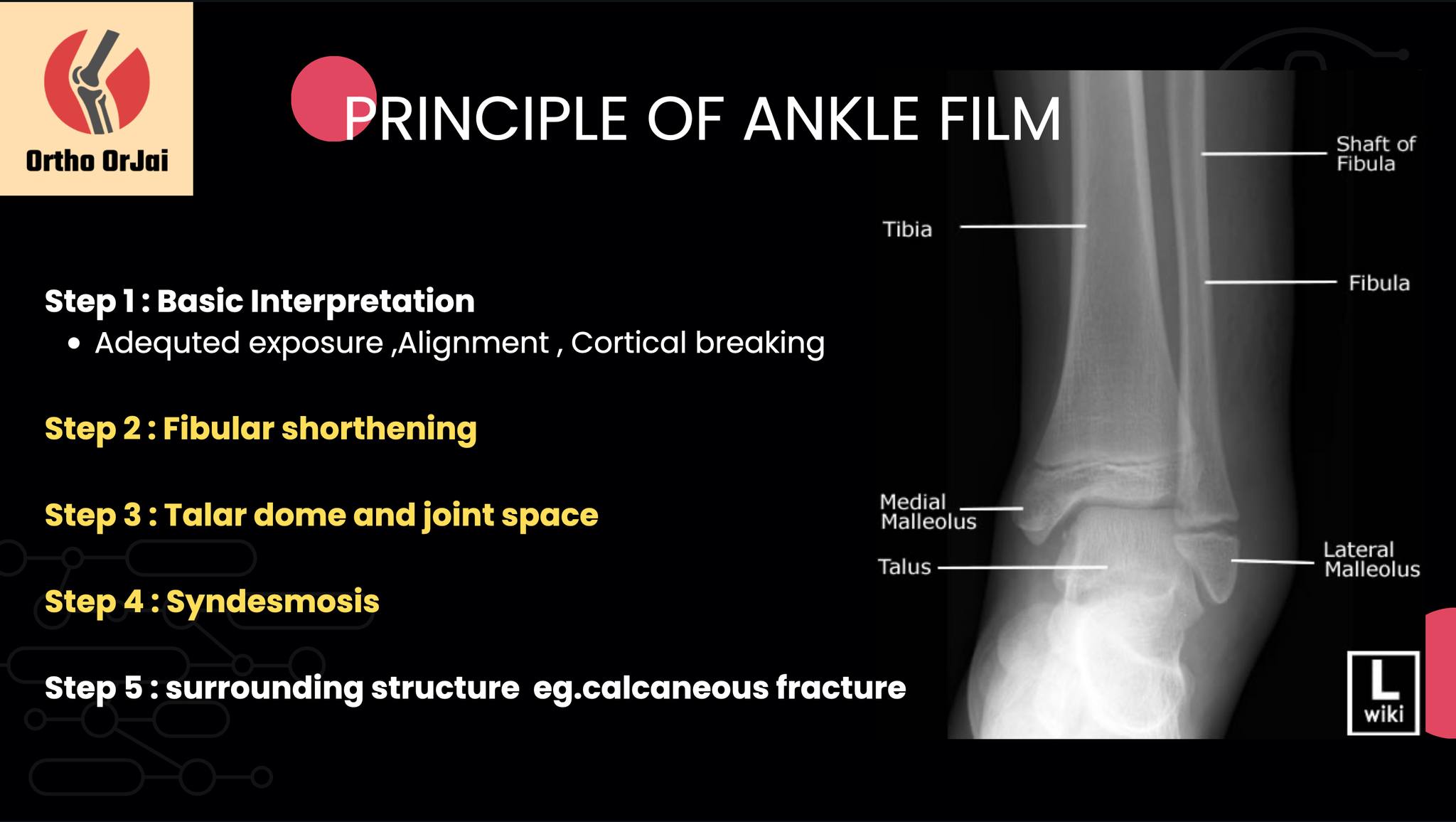 Ortho - มาเข้าสู่เนื้อหาหลักกันนะครับ คือเรื่องของการ อ่าน film แน่นอน ...