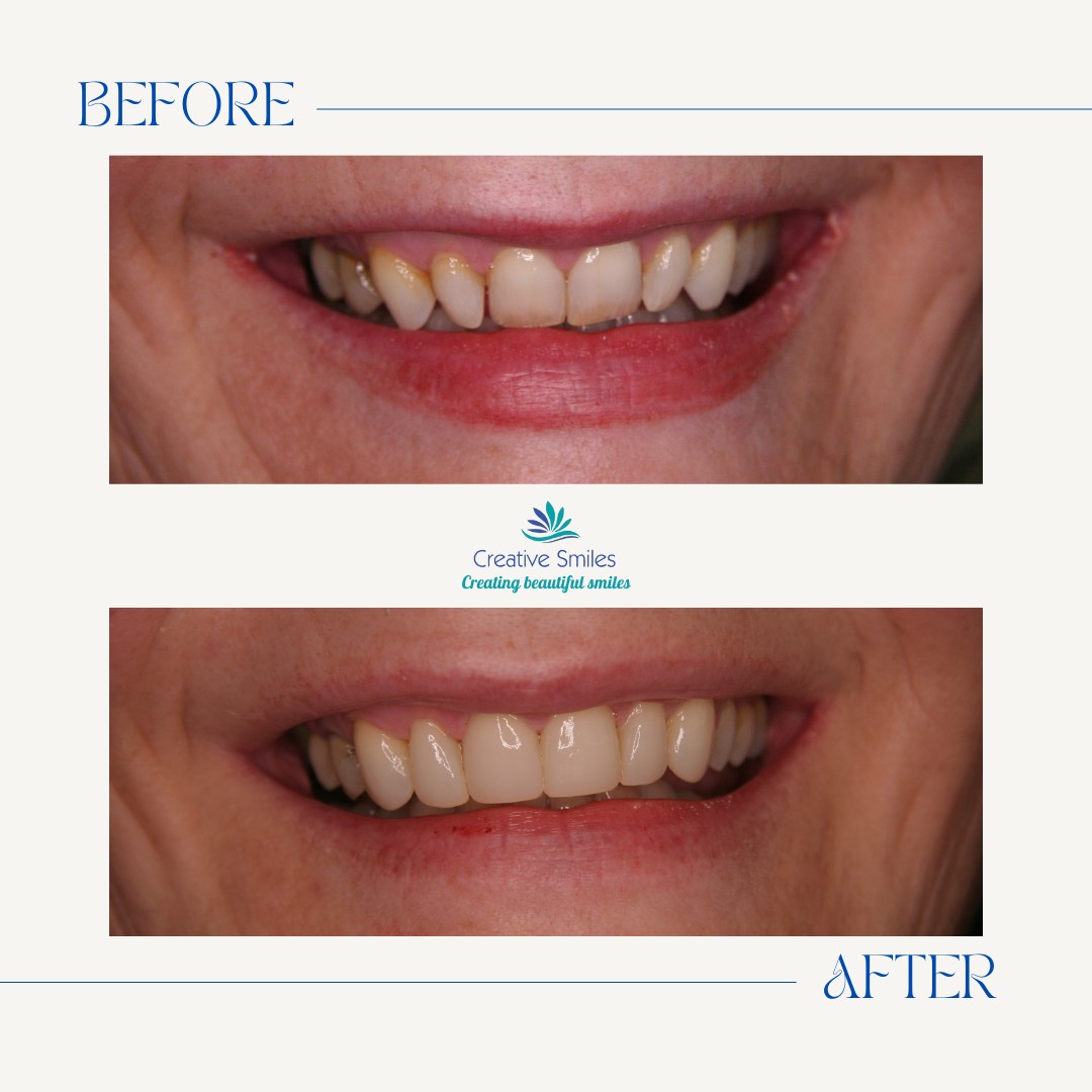 Creative - Smile Transformation Alert! Incredible smile makeover ...
