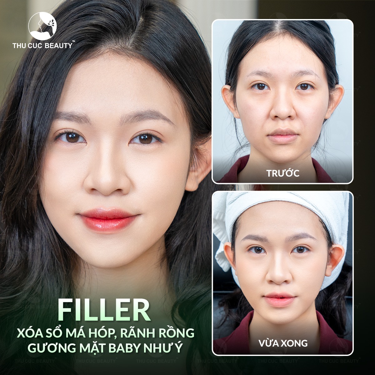 Bệnh Viện Thẩm Mỹ Thu... - Bệnh Viện Thẩm Mỹ Thu Cúc Hà Nội