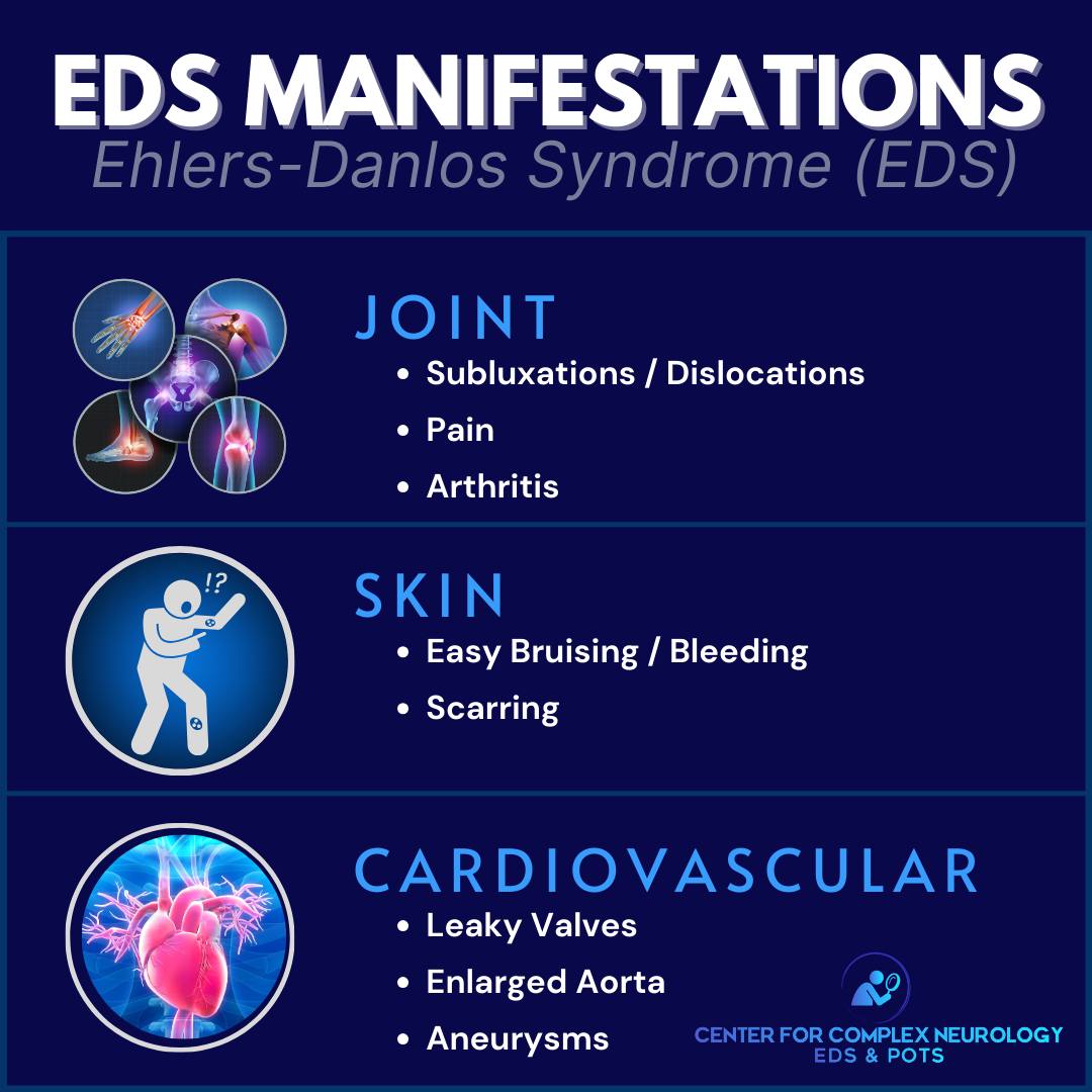 Center for Complex Neurology, EDS & POTS - 🌟 Living with Ehlers-Danlos ...