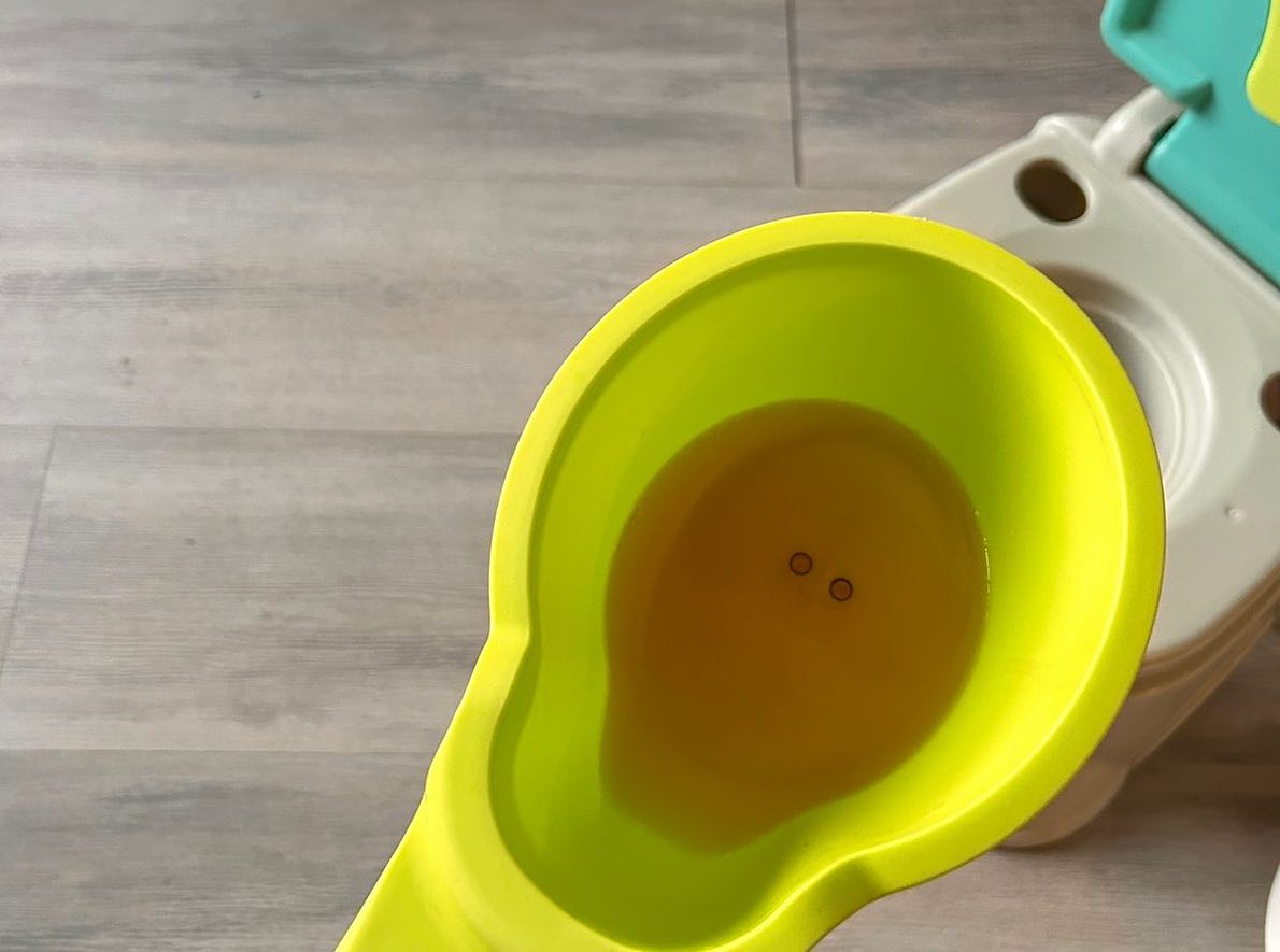 Dra. Yun - 🚽 Orina rosa en la semana 🏥Consulta típica de... | Facebook
