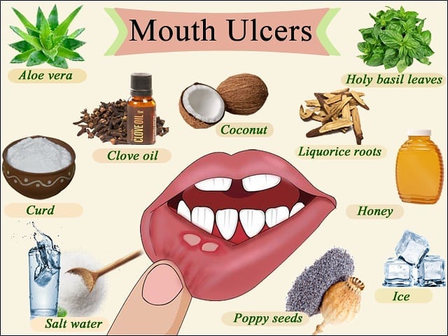 dental_strings - UNIVERSAL TOOTH NUMBERING SYSTEM For more information ...