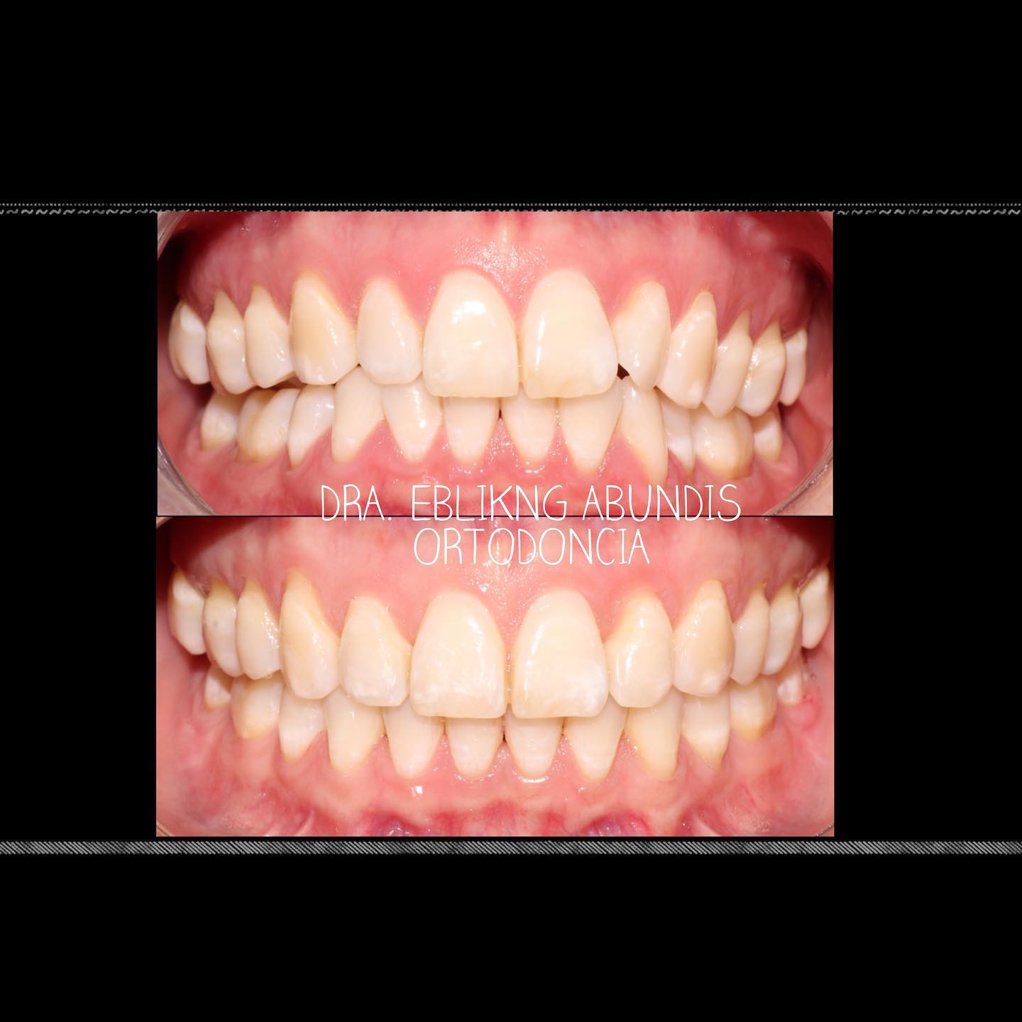 Finalización de retratamiento de... - Dental Artist Mexico | Facebook