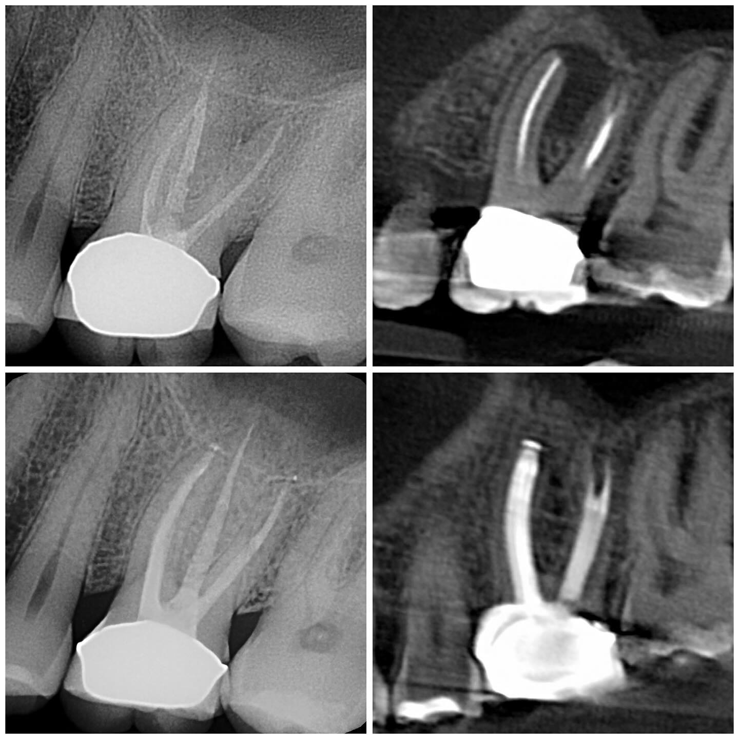Metro Endodontics | Toronto ON