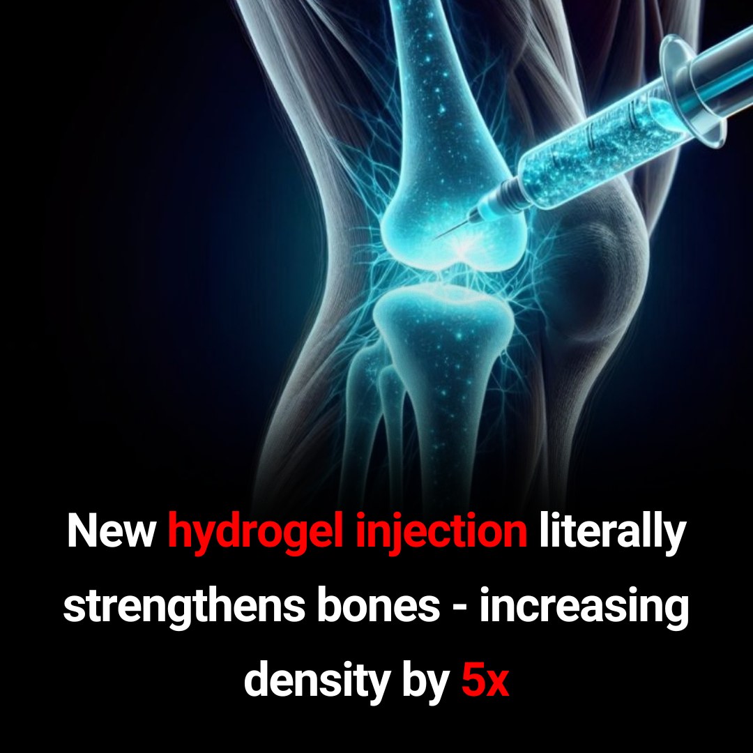 Feedy - A new Injectable Gel Boosts Bone Density 5X 👇 | Facebook