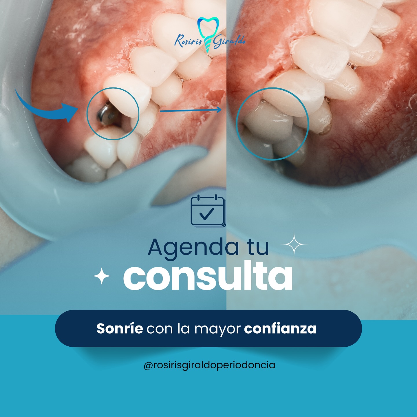 Rosiris Giraldo Periodoncia Especializada | Bucaramanga