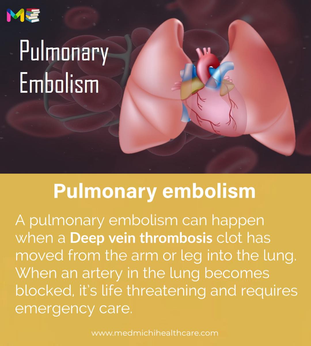 MedmichiHealthcare.com - 📚Full note on DEEP VEIN THROMBOSIS [with pdf]👉 ...