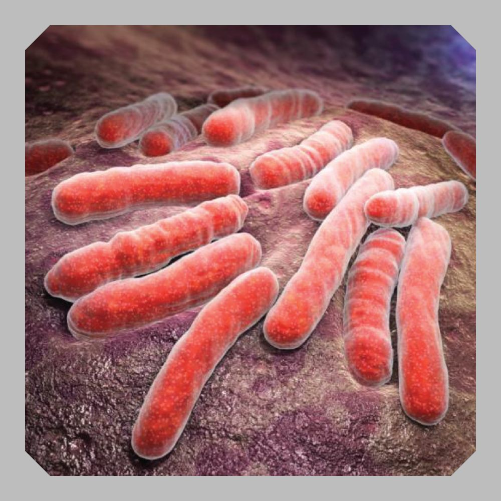 Cryptic Tuberculosis - An atypical... - Pasindu's Archives