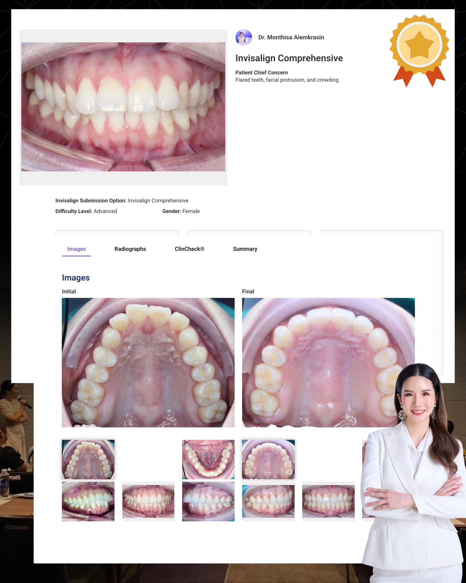 Dente... - Dente Align Clinic - Invisalign Diamond Provider | Facebook