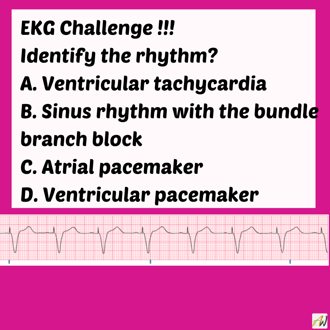 EKG - EKG Challenge!!! Identify the rhythm? A. Ventricular tachycardia ...