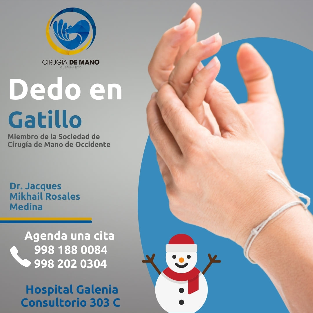 el-dedo-en-gatillo-es-una-afecci-n-en-la-que-uno-de-los-dedos-queda