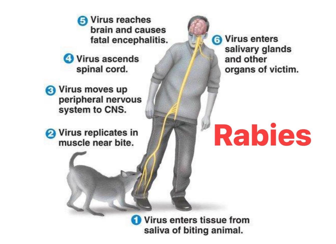 Rabies ( source: The 5-Minute... - Hari Bista- हरि बिष्ट | Facebook