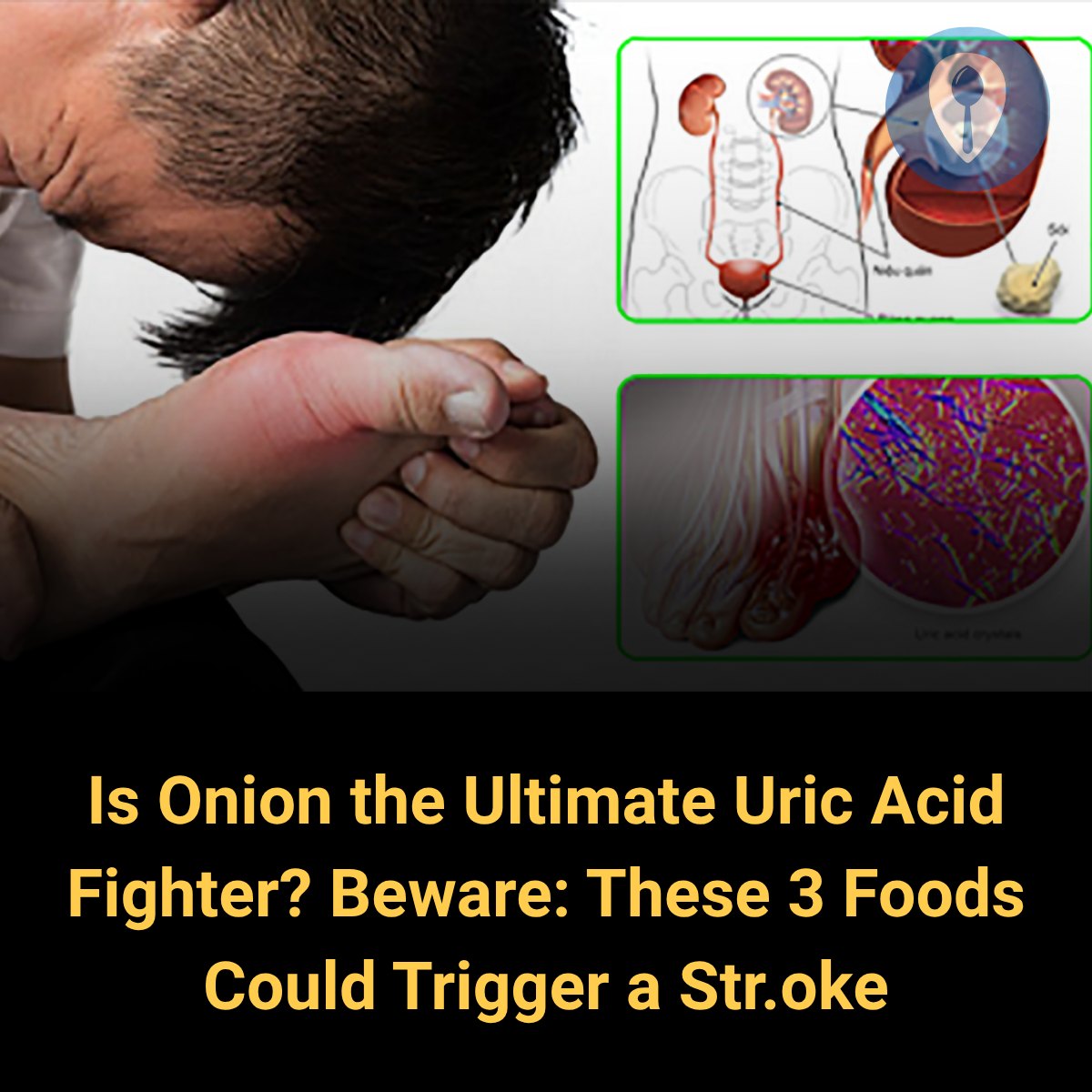 Feedy - Avoid These 3 Foods to Reduce Str.oke Risk | Facebook