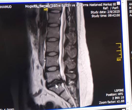 bpc 157 sciatica reddit Ipamorelin Peptide Therapy in Florida: The Gentle Path to Recovery &  Vitality main image 1