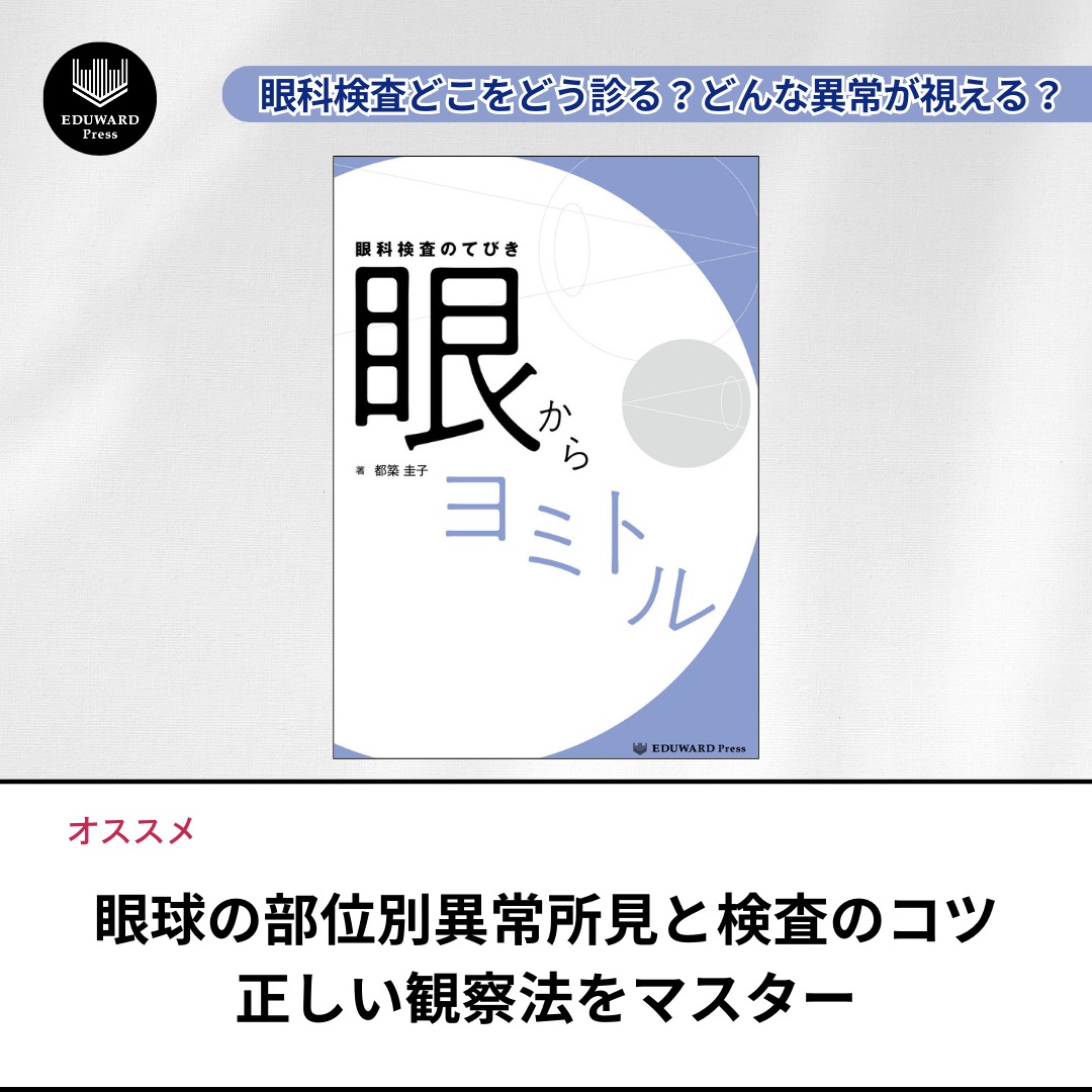 眼科検査のてびき 眼からヨミトル Amazon.co.jp: 眼科検査のてびき 眼