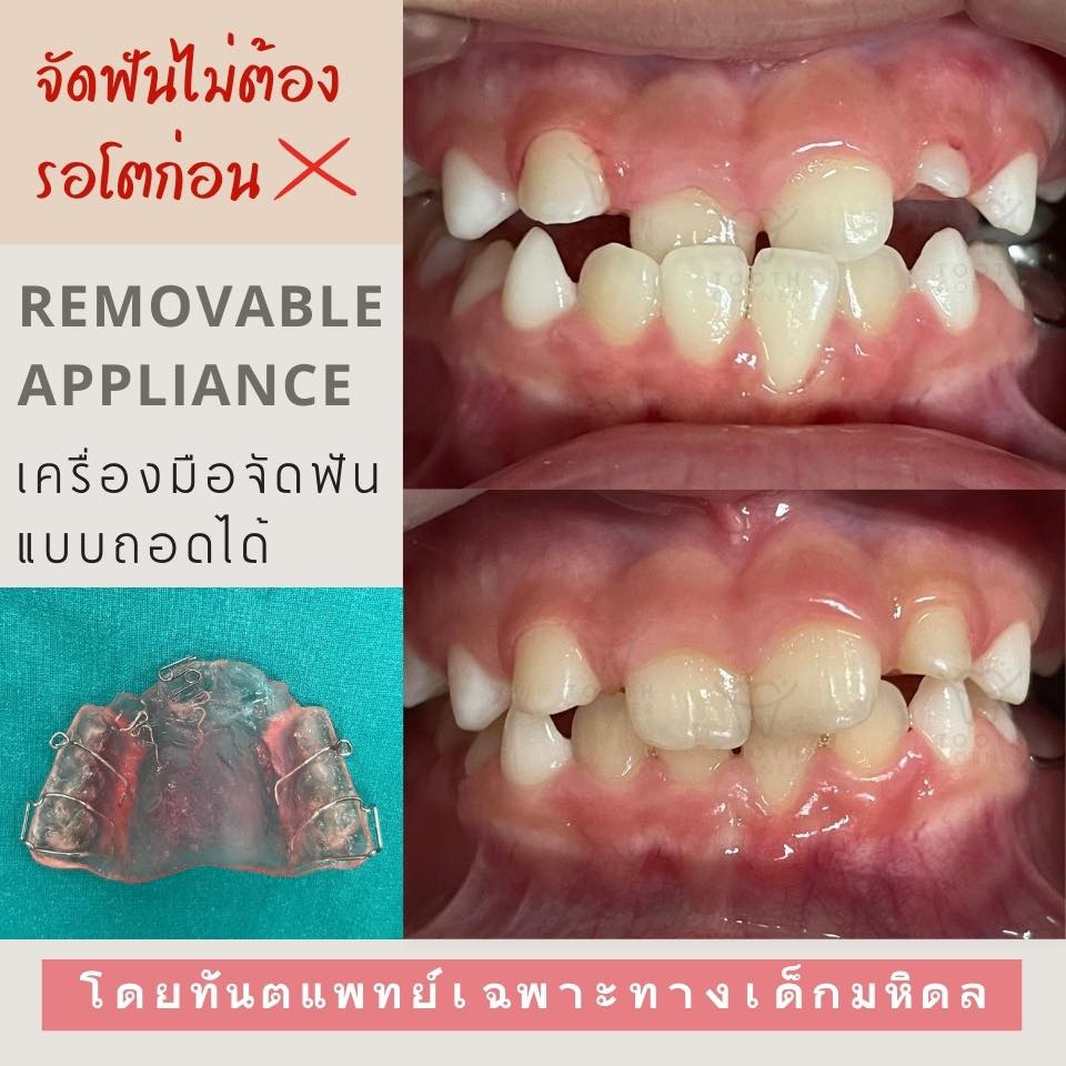 Tooth Corner... - Tooth Corner Clinic - ทูธคอร์เนอะ สหคลินิก