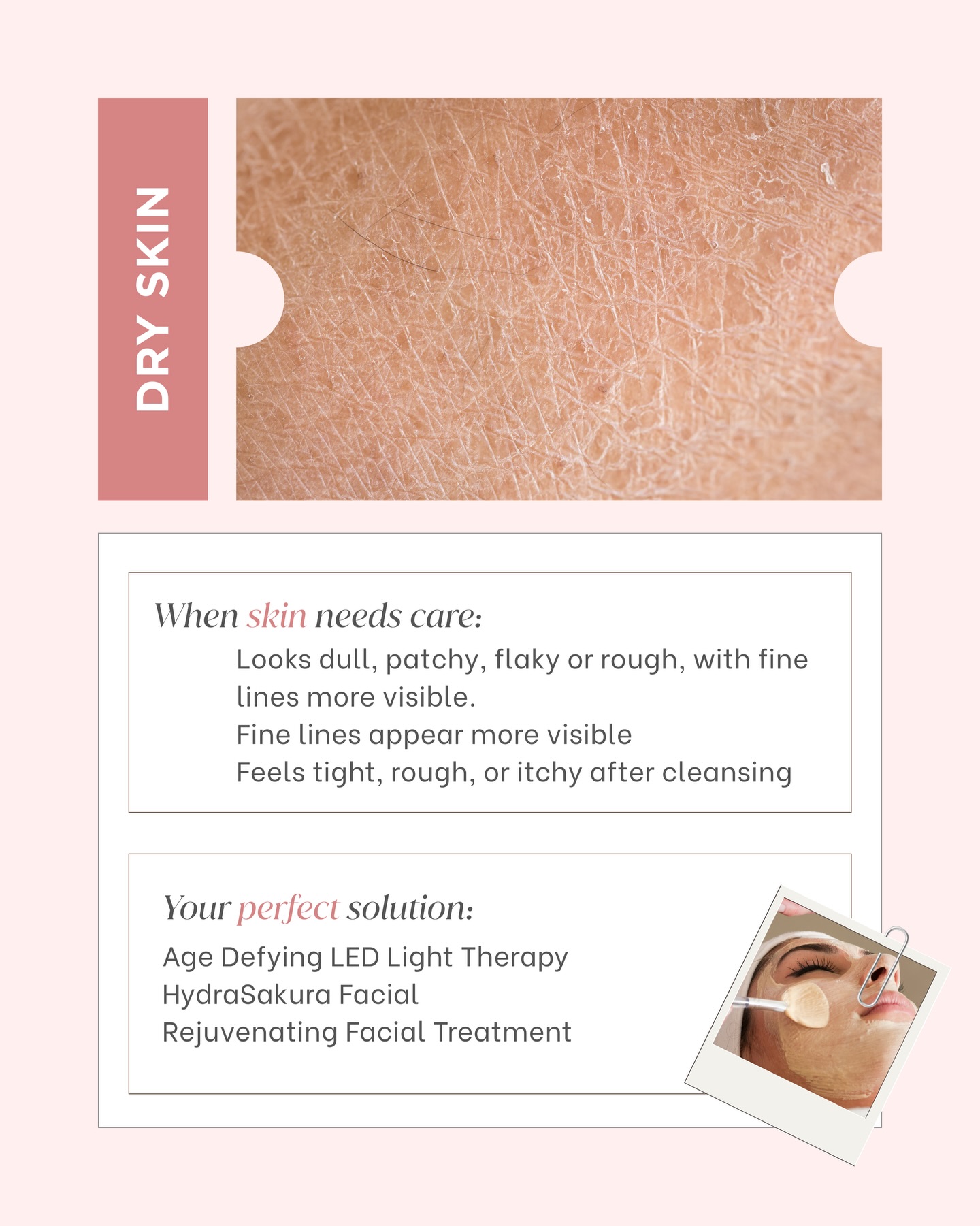 Skin Perfect - Skin Perfect added a new photo.