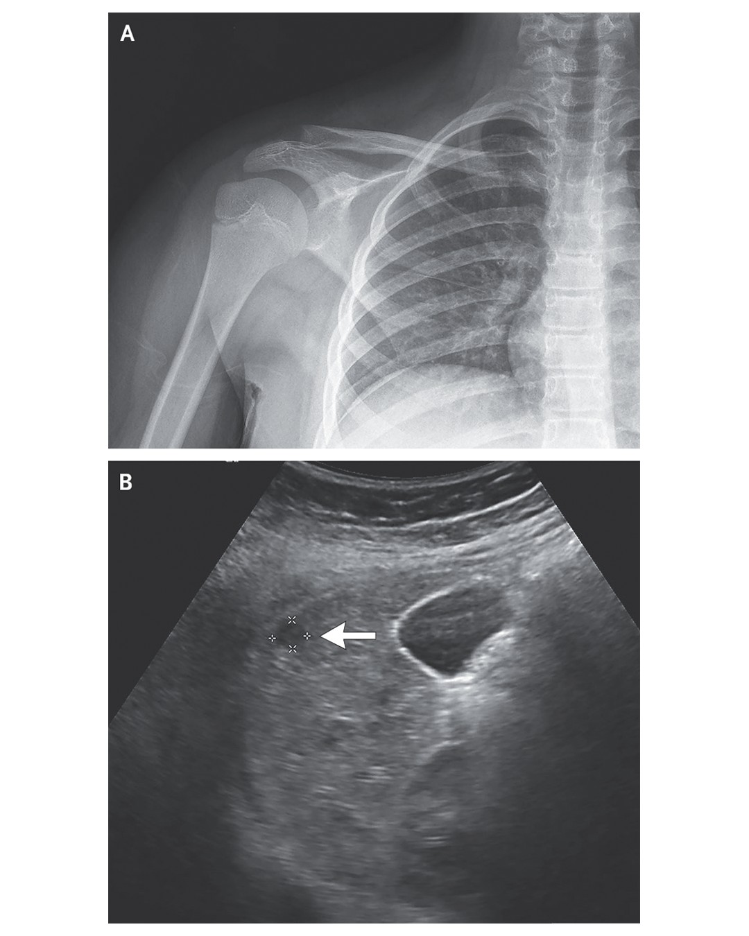 The New England... - The New England Journal of Medicine