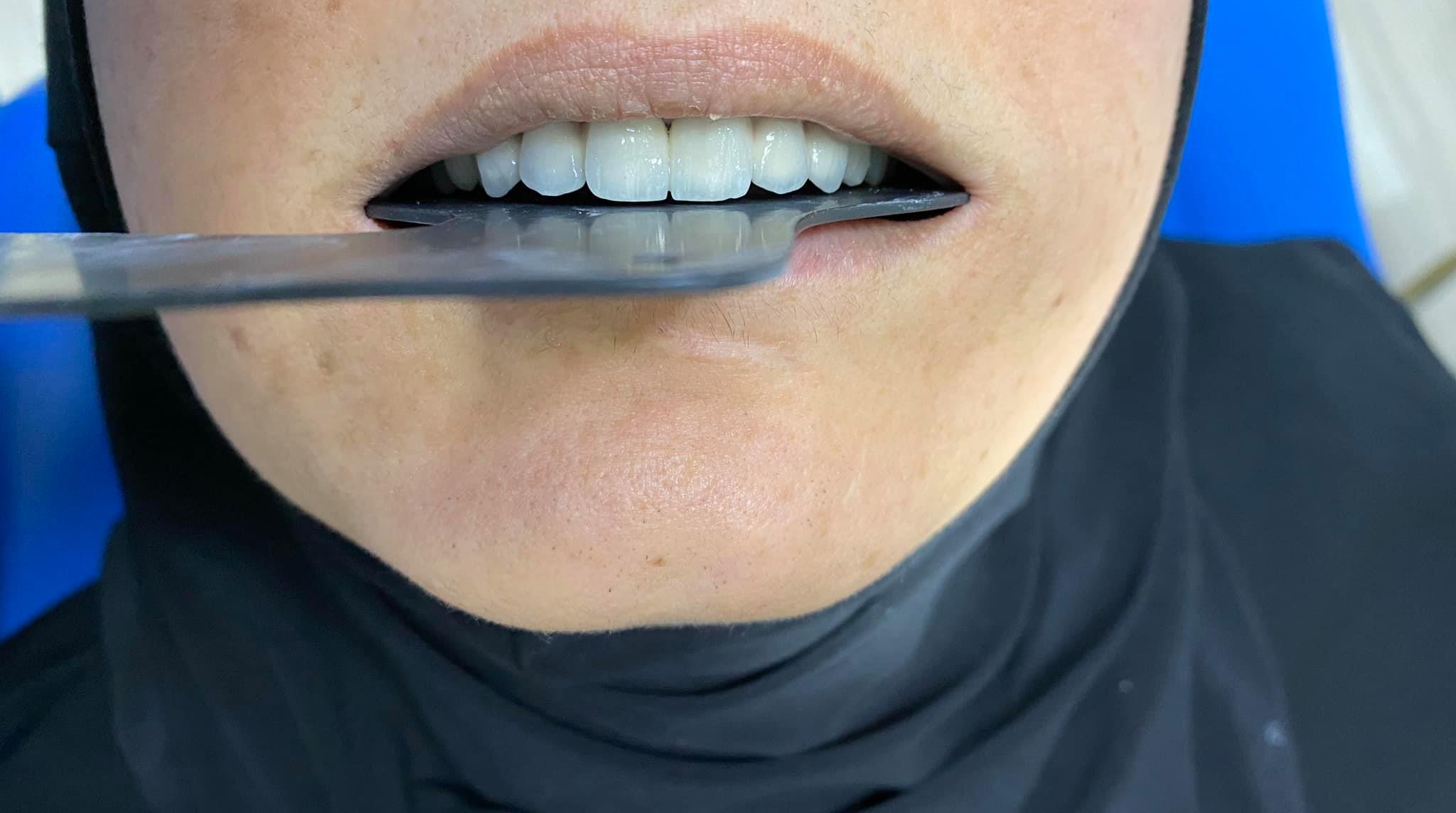 Dr Farman Hamza dental clinic کلینیکی دكتۆری ددان
