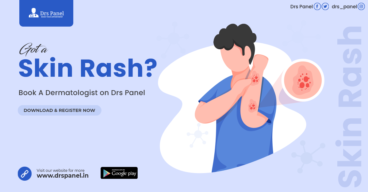 Drs panel - Got a skin Rash?? Book a Dermatologist on Drs...
