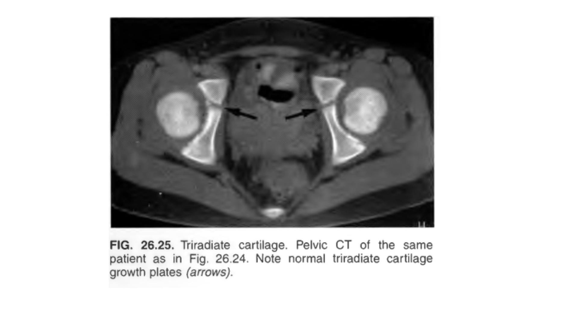 Radiology Tips - #paediatric #ECR2019 | Facebook