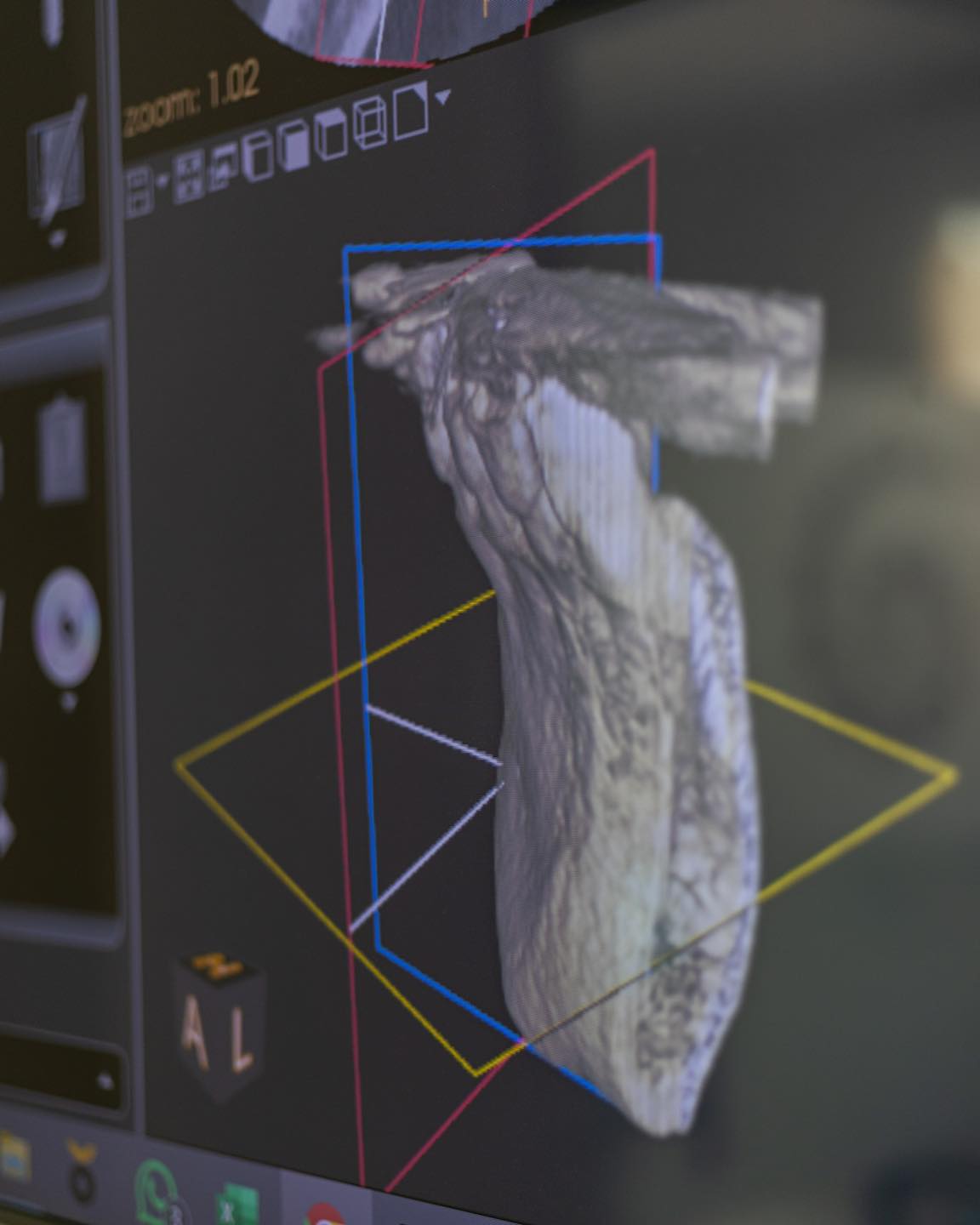 ¿Sabías que una radiografía 3D... - Centro Alexander Czech | Facebook