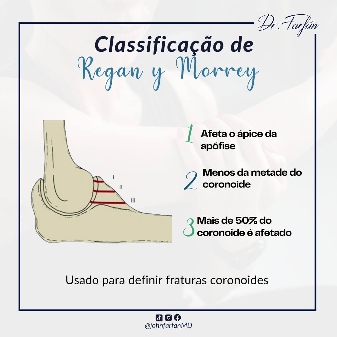 📌 Clasificación de Regan y Morrey 📌... - Dr. John Farfán R