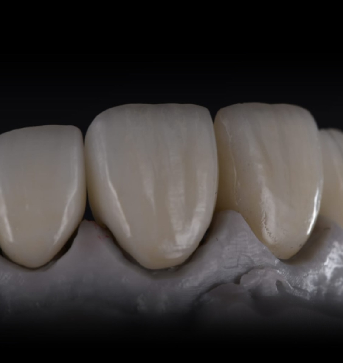 Biterite Dental Laboratory | London