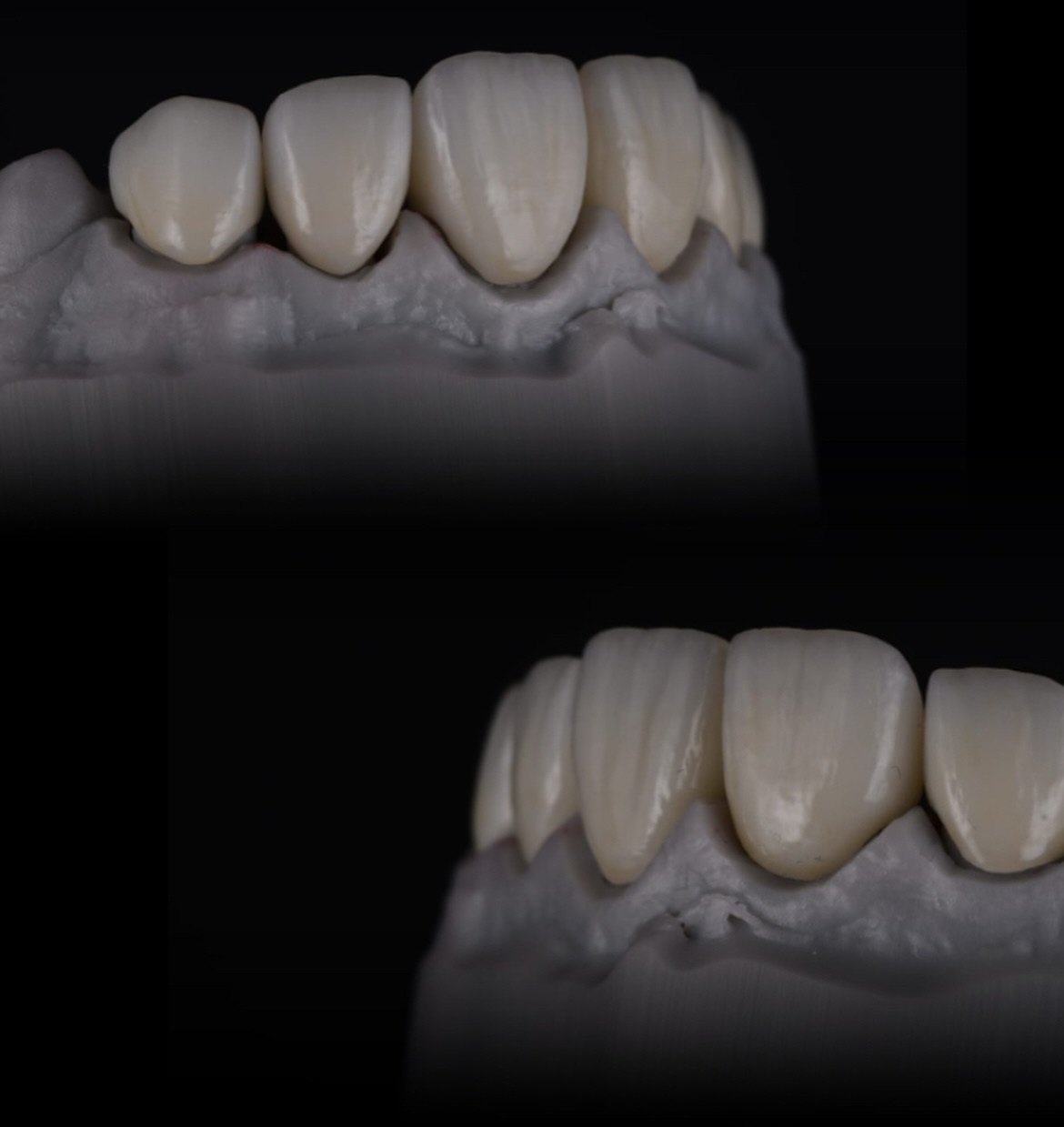 Biterite Dental Laboratory | London