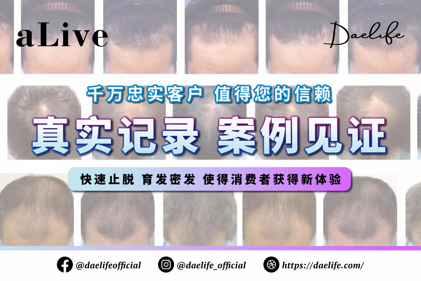 阿豪 - 养发王 DLive
