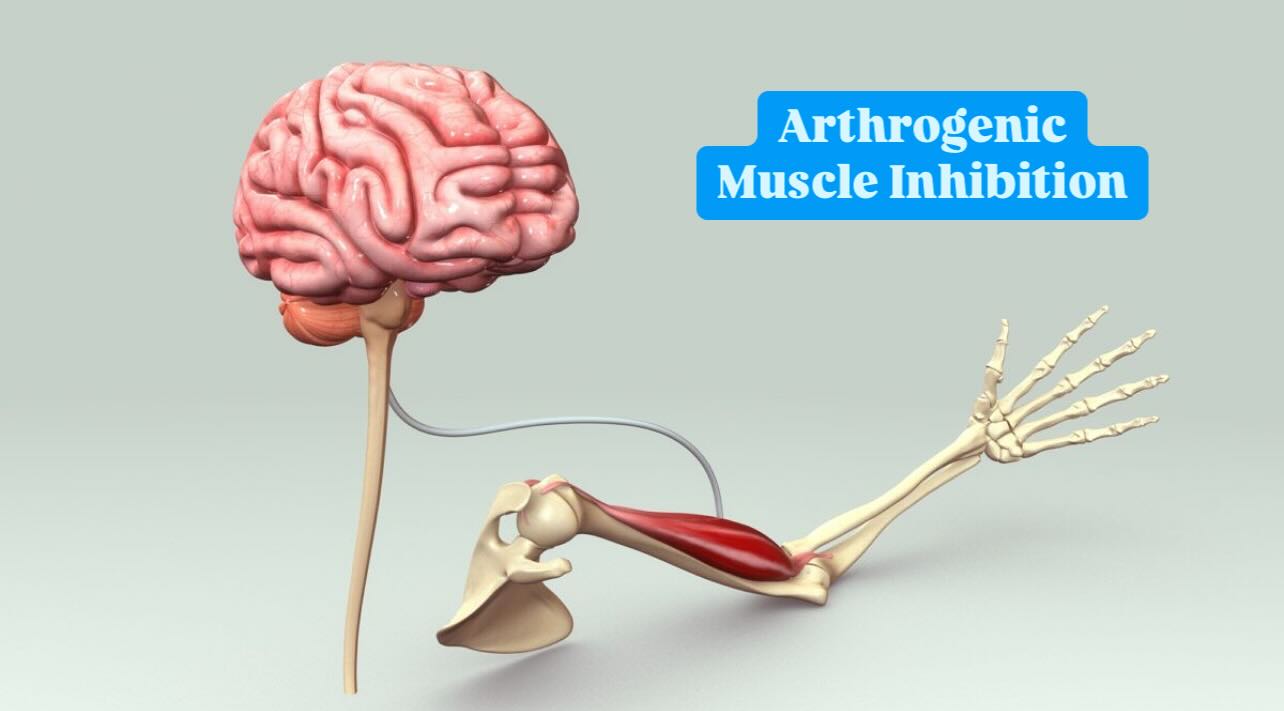 MSK - Arthrogenic Muscle Inhibition 🔬 BREAKING DOWN AMI: The Hidden ...