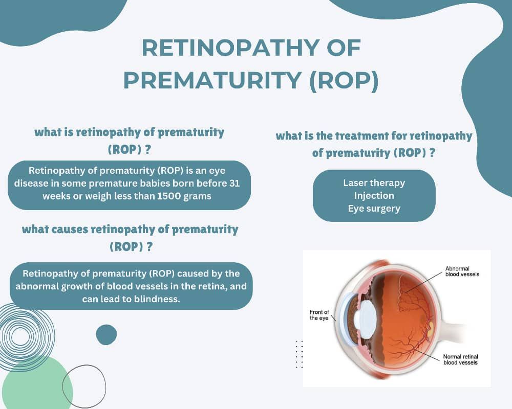 C Optometrist | Putatan