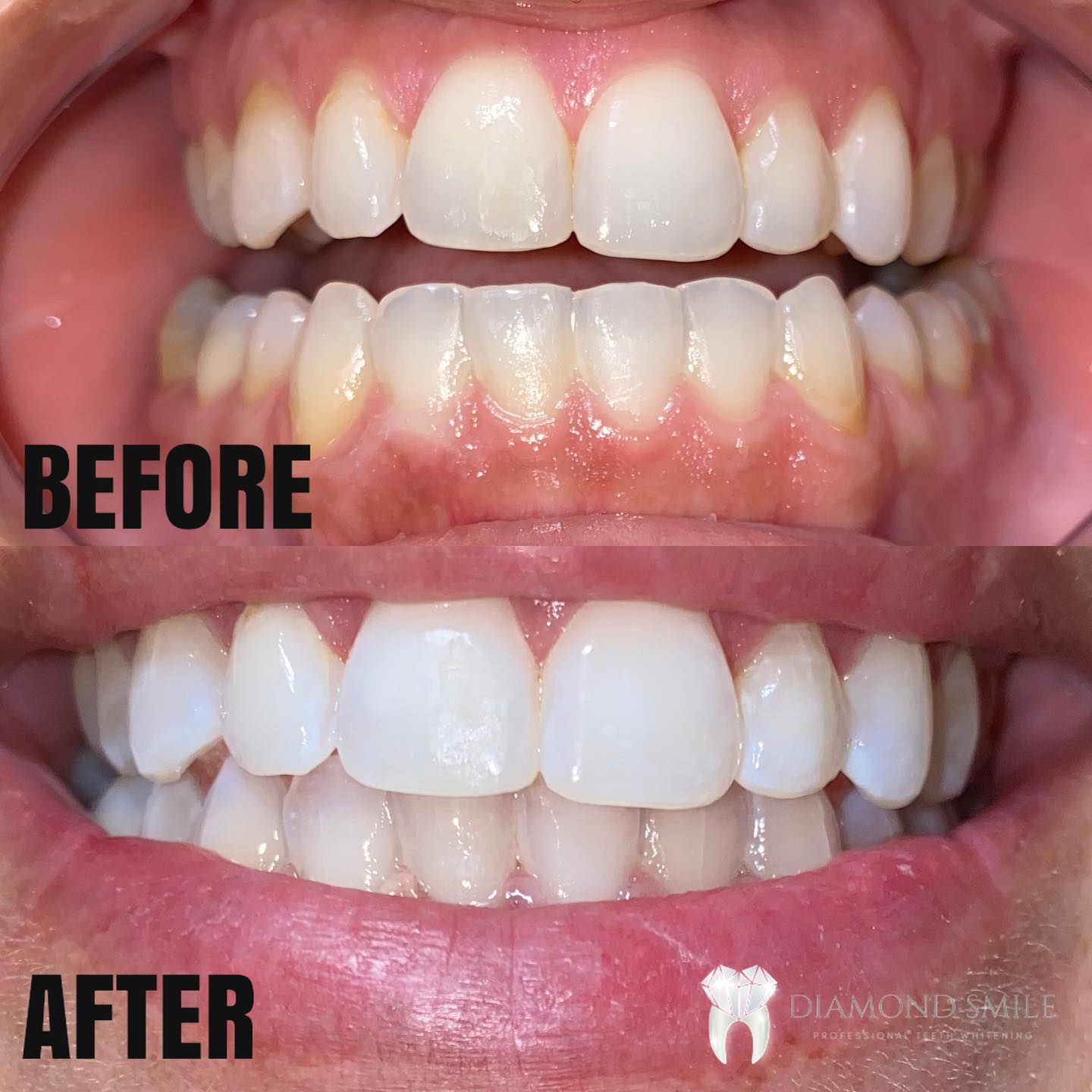 Diamond Smile | Delano CA