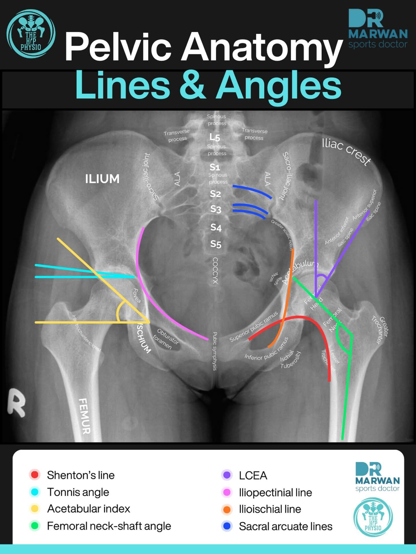 Anatomy - How to measure X-rays When assessing hip pain, instability ...
