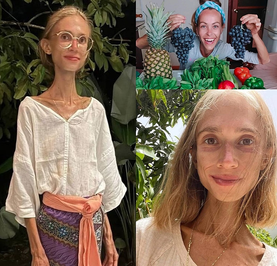 Shauwn - RIP Karolina Krzyzak, a 27-year-old woman who only ate fruits ...