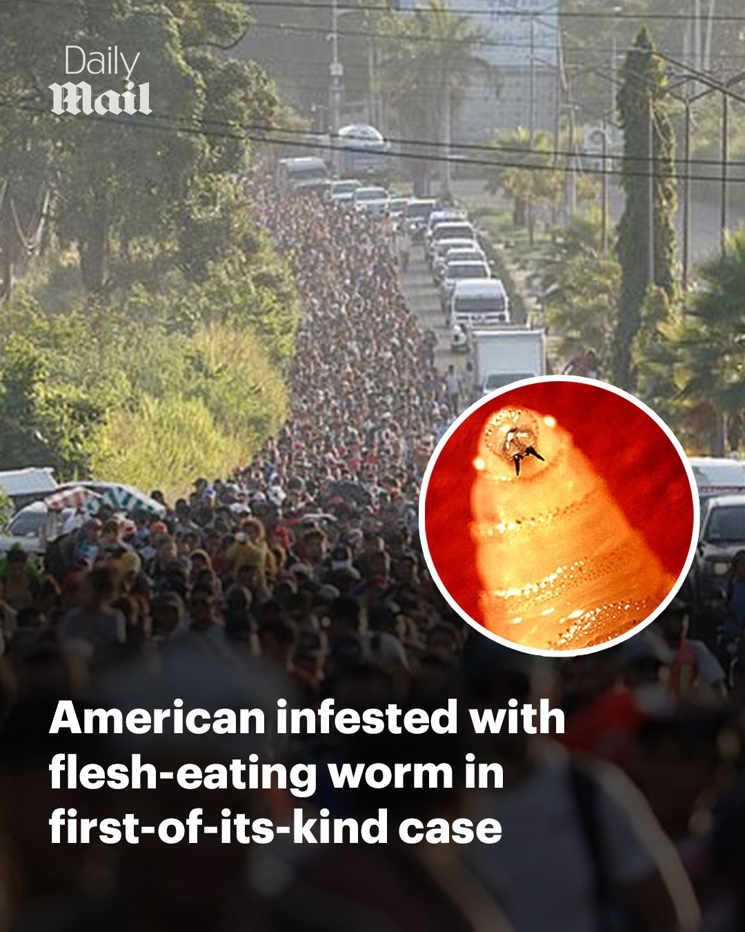 The parasite eats living flesh and... - Daily Mail Video | Facebook