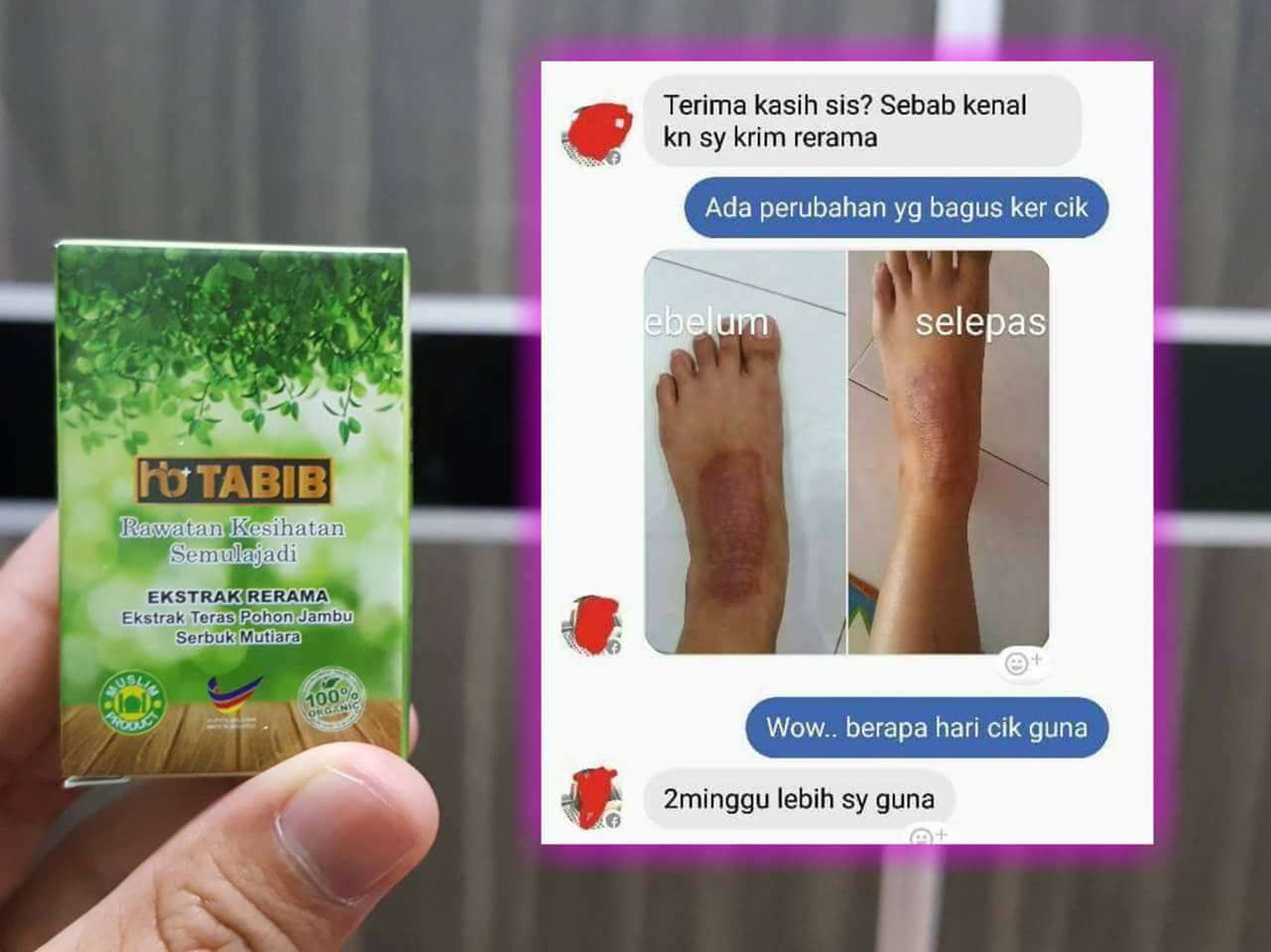KRIM Herba... - KRIM Herba Rerama - Rawat Penyakit Kulit