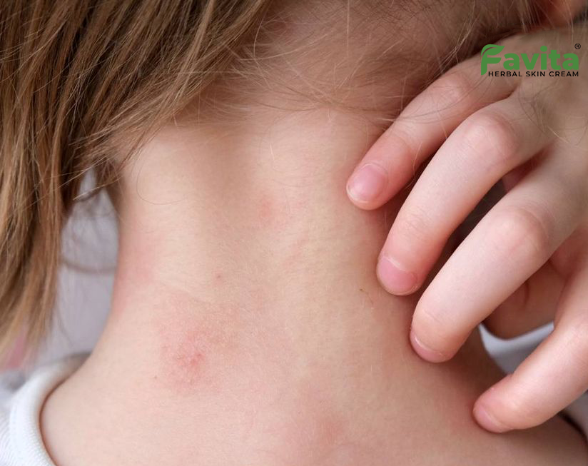 Favita - Solution for skin problems - 📍 Did you know? The more you ...