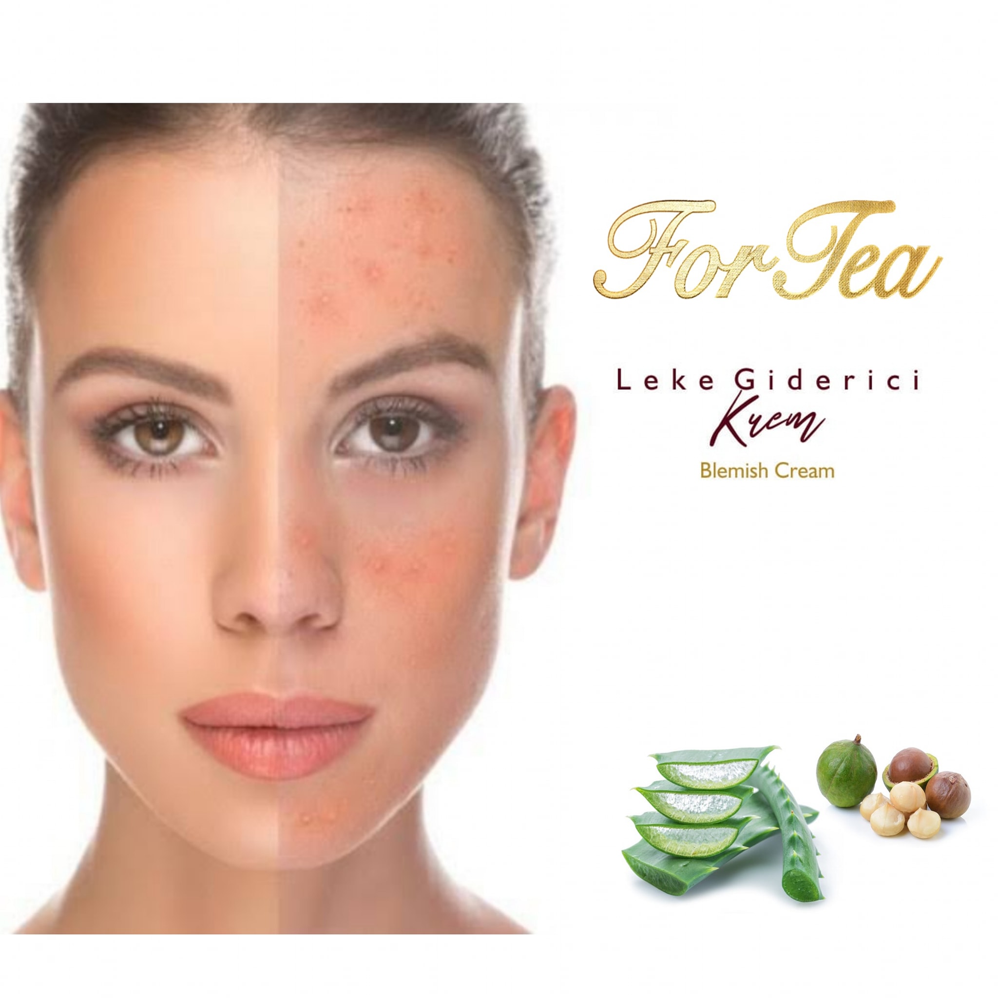 FORTEA - FORTEA Leke Giderici Krem 🌸 Cilt lekeleri, güneş...