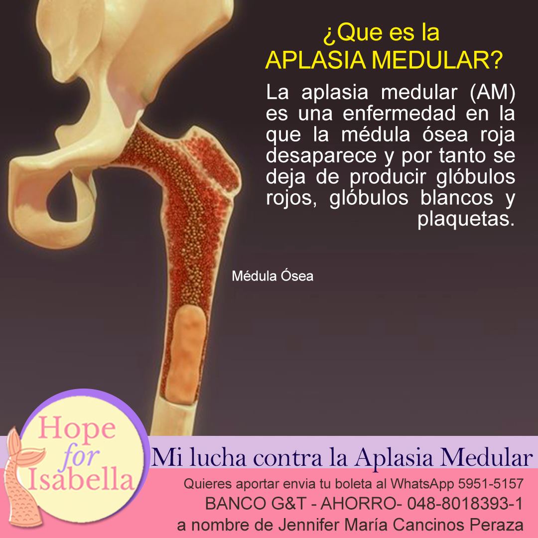 Hope - QUE ES APLASIA MEDULAR / ANEMIA APLASICA ⁉️ es una afección rara ...