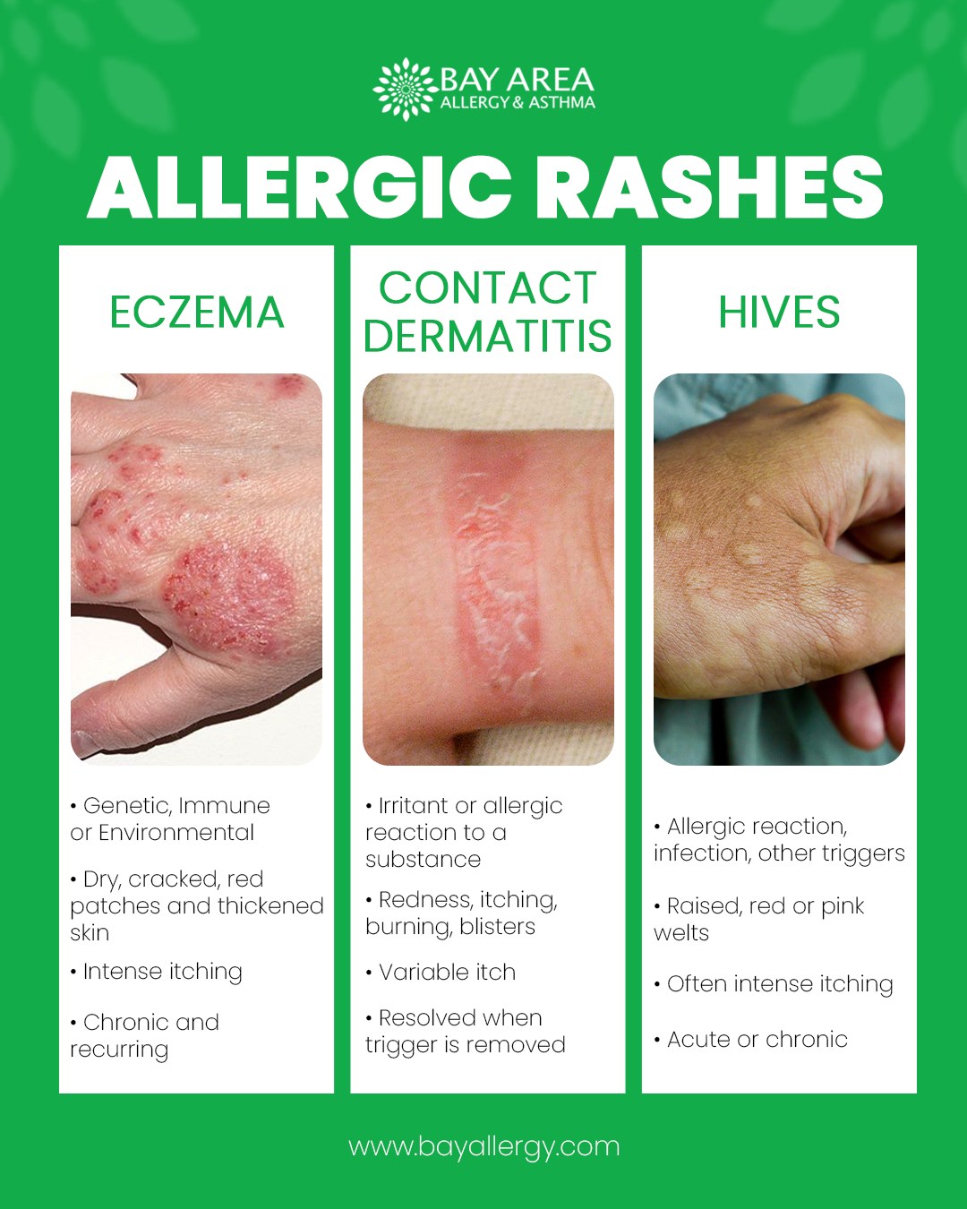 🩹 Struggling with itchy,... - Bay Area Allergy & Asthma | Facebook