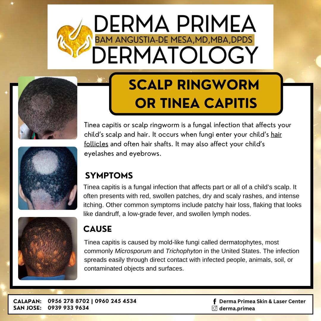 Derma Primea Skin & Laser Center | Calapan
