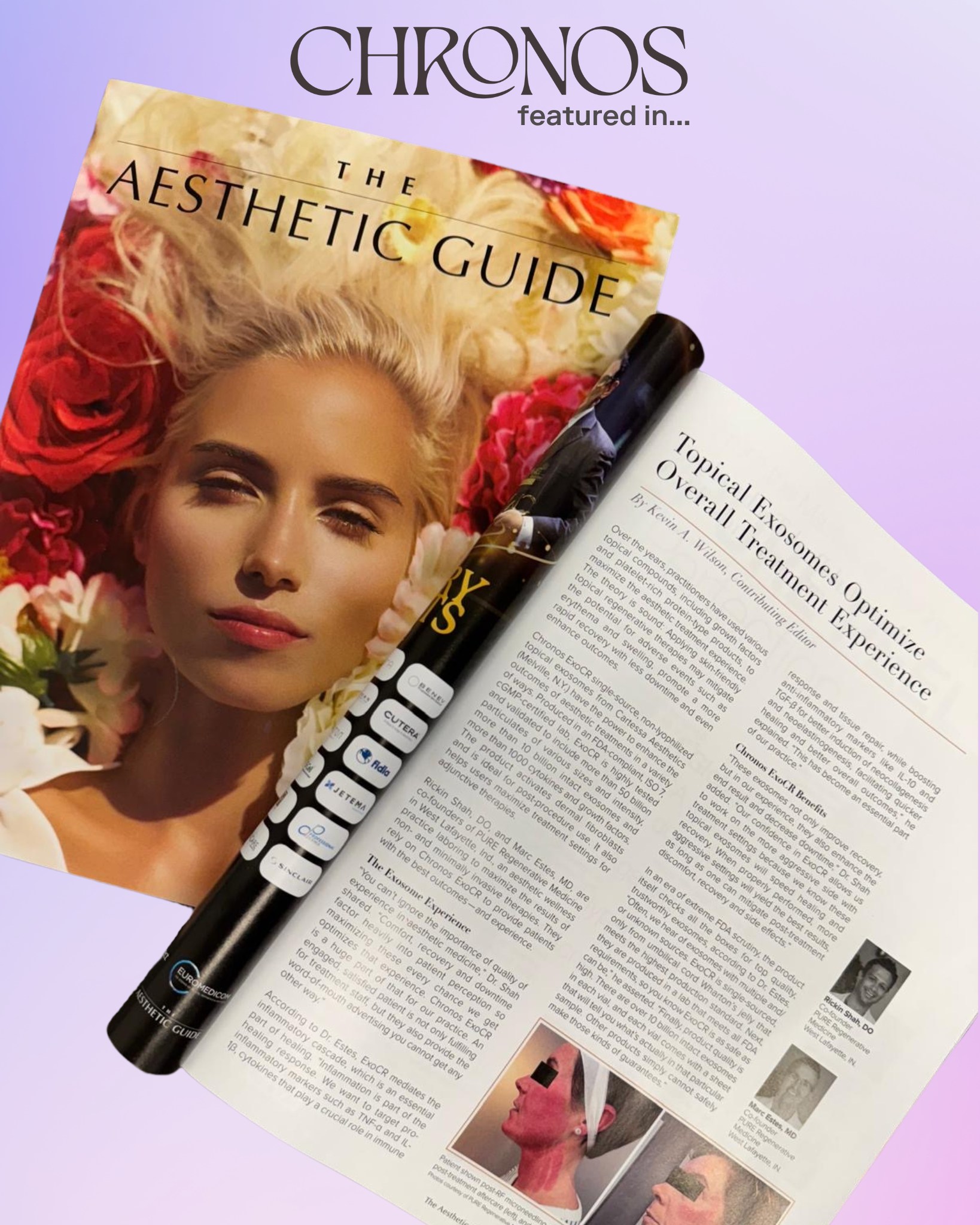 Cartessa - 📰 Chronos EXO CR featured in The Aesthetic Guide! The March ...