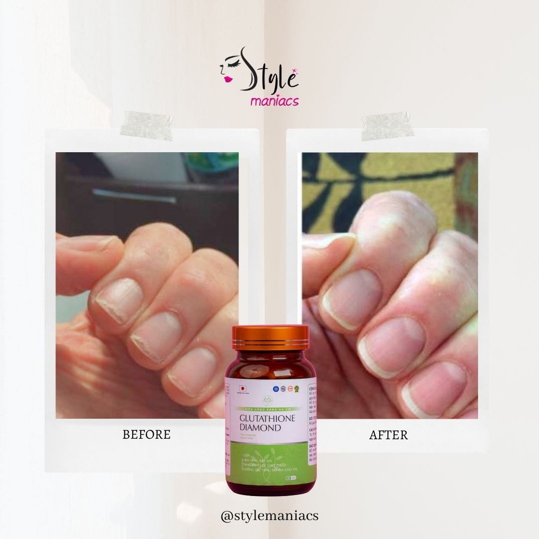 glutathione diamond ✨ Capsule ভিতর থেকে আসল বিউটি কেয়ার ✨ শুধু মুখ নয়,হাত, পা, নখ, হেয়ার আর পুরো শরীরের জন্য একটাই সল্যুশন। 💎 Glutathione Diamond Capsule কাজ করে ESTHER FORMULA Lyuh Esther Size:10mg paraben-free-icon