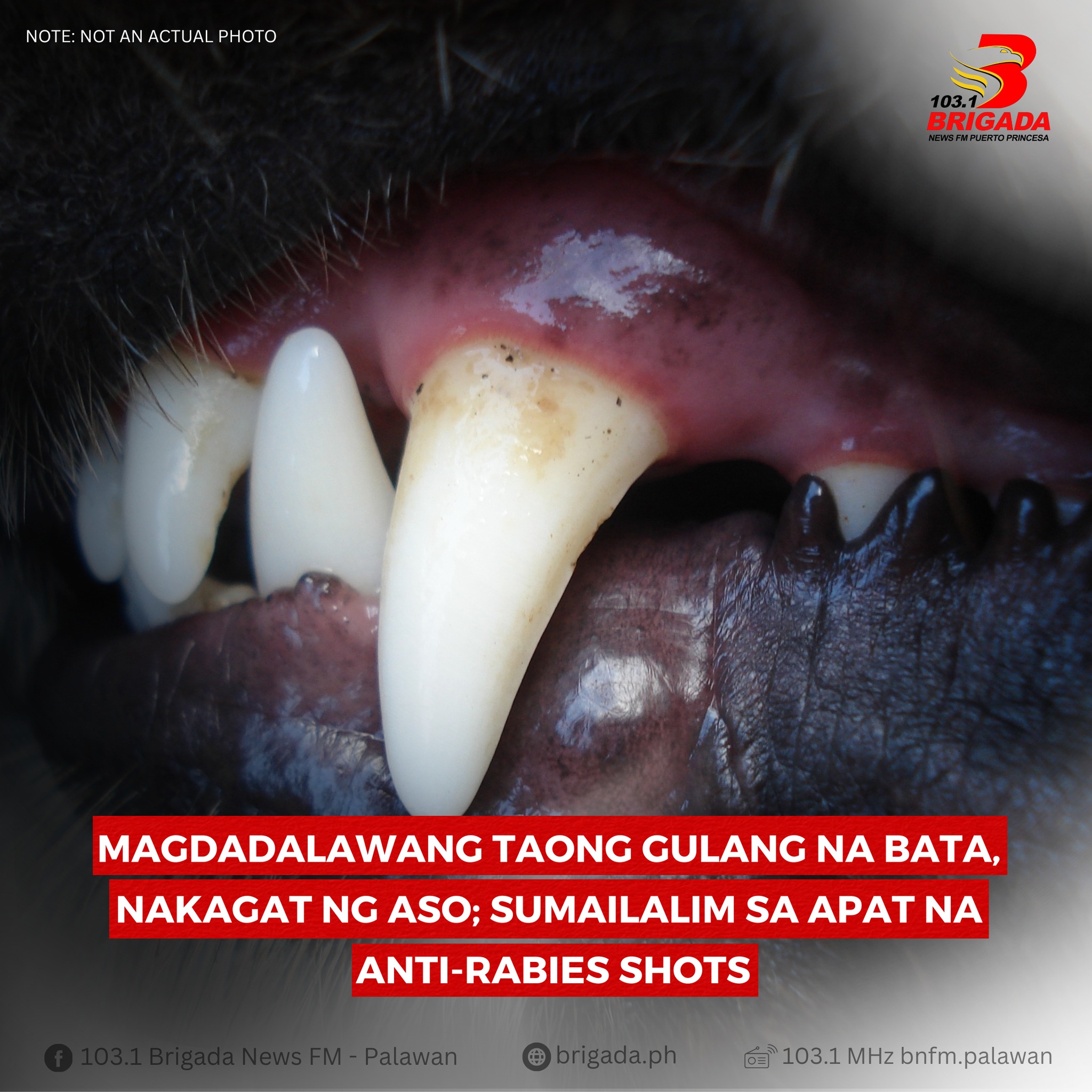 103.1 - MAGDADALAWANG TAONG GULANG NA BATA, NAKAGAT NG ASO; SUMAILALIM ...