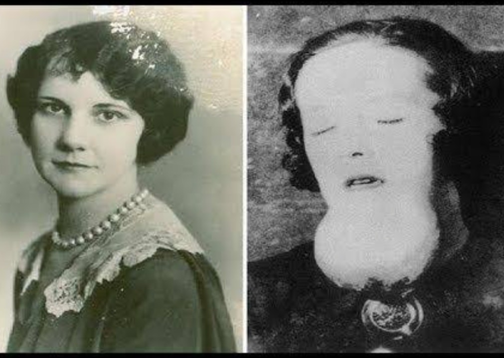 The Unknown; - The Radium Girls: Luminous Tragedies, Lasting ...