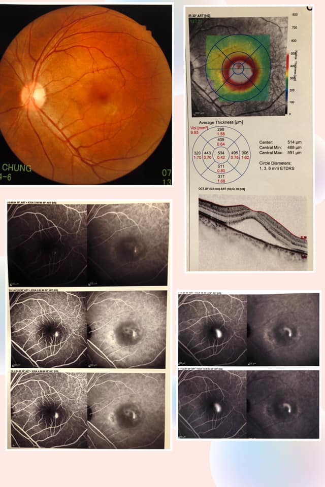Dr. Sin Pui Yee Helena - Ophthalmologist 冼佩儀眼科專科醫生